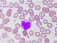 A Guide to Monocyte Markers