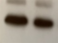 Phospho-PI3 Kinase p85 Antibody Works Well