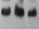 PTEN Antibody for Western Blot