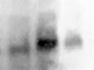 Cleaved Caspase 3