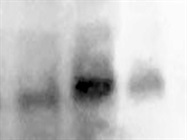 Cleaved Caspase 3