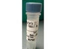 P-PKC Alpha and Beta II for Western Blot