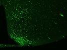 Phospho-STAT3 Activation in the ARC