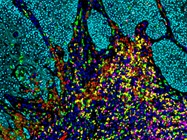 The Advantages of Multiplexing Biomarker Analysis