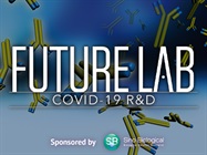 Anti-virus Antibody Development Combining Speed with Sensitivity and Specificity