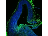 Immunostaining for Hif1 Alpha