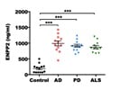 Detection of Autotaxin (ATX;ENPP2)