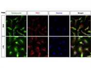 Detection of PKD1 in Primary Microglia