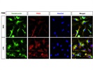 Detection of PKD2 in Primary Microglia