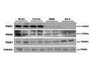 Detection of PKD3 Expression: Successful