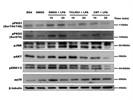 Detection of Phospho PKD2 in Primary Microglia