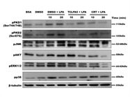 Detection of Phospho JNK in Primary Microglia