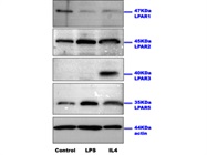Expression of LPAR5 in Microglia Cells