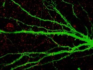 Determining the Inhibitory Synapses Using Anti-Gephyrin Antibody