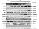 Detection of IKK Activation