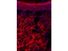 MFAP5 in Mouse Skin Wounds