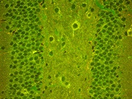 Comparison of Immunostaining Techniques