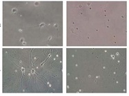 Improve the Quality of Your Sorted Cells with Microfluidic Technology