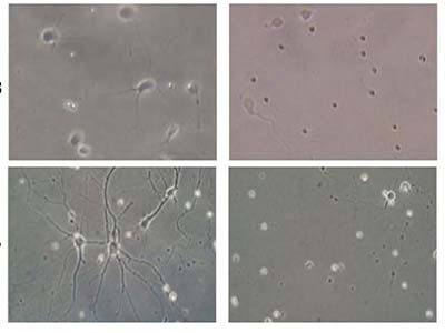  Improve the Quality of Your Sorted Cells with Microfluidic Technology