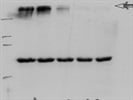 Great Antibody to Detect ABCA1