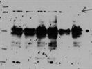 Not the Best Antibody for Immunodetection of Culin2