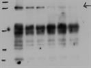 Good Antibody to Detect Culin2