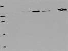 Excellent Antibody for Immunodetection of iNOS Protein