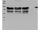 Works Well for Immunodetection of CD36 Protein