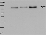 Excellent Phospholipase C beta 3 Antibody from Abcam