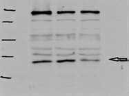 Good Antibody for Immunodetection of p53