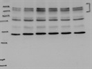 Good Specificity for Immunodetection of FLT4