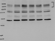 Good Specificity for Immunodetection of FLT4