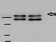 Best Antibody for Immunodetection of ACC in Humans