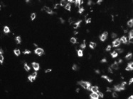 Anti-human CD8-FITC Monoclonal Antibody for IF