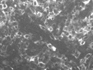 Detection of CD53 in Lymphoma