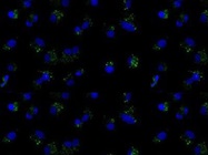 Targeting Autophagy Is a Promising New Therapeutic Strategy