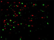 Advanced Tools Boost Protein Trafficking Research