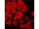 Anti-Rab5 Antibody That Works Great for IF