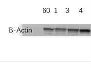 Anti-ß-Actin Antibody Works Well for Western Blot