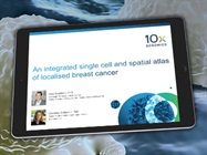 [On-Demand Webinar] Adding Spatial Analysis to Your Experimental Toolkit for More Context