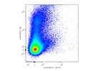 Detection of Plasma Cells Could be Better