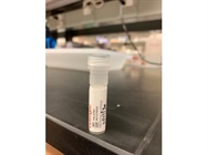 Chemoattractant on Rab27A Expression