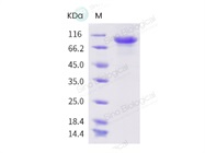 Coronavirus SARS-Cov-2(2019-nCoV) Spike S1-His Recombinant Protein