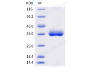 SARS-CoV-2 (2019-nCoV) Spike RBD(N501Y)-His Recombinant Protein