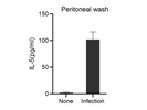 The IL-5 ELISA Kit Worked Well