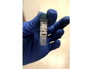 Granzyme B Antibody is Great for Western Blotting