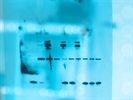 How to Select the Best Western Blot Detection Method