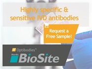Choosing the right antibody for immunohistochemistry (IHC) could be tricky, but not anymore with our OptibodiesTM!
