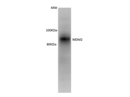 MdM2 Antibody Works Well