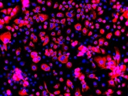 Anti-Cytokeratin 18 Antibody